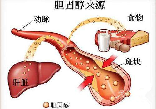 澳門2025正版資料免費(fèi)公開,牙周病患者腦卒中可能性大增